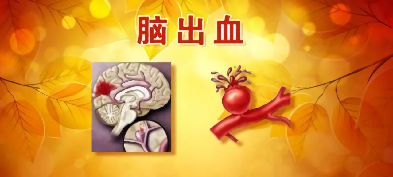脑出血后遗症的康复训练