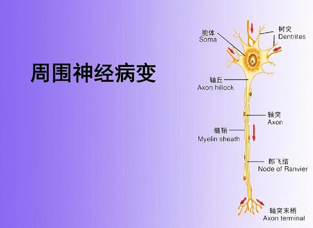 周围神经损伤后的治疗方案的选择