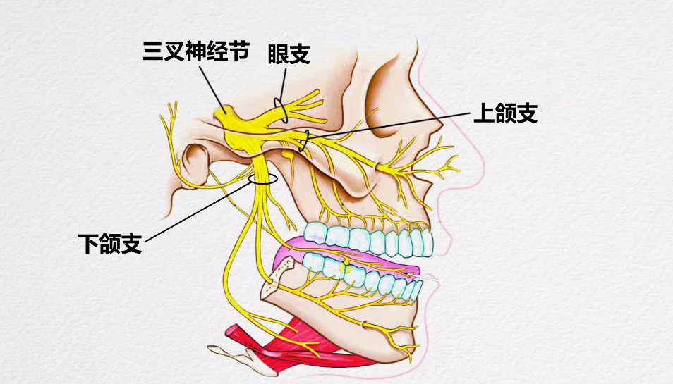 牙疼与三叉神经痛主要区别