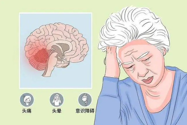 脑外伤后遗症都有哪些?