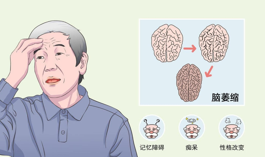 小脑共济失调应该如何治疗?