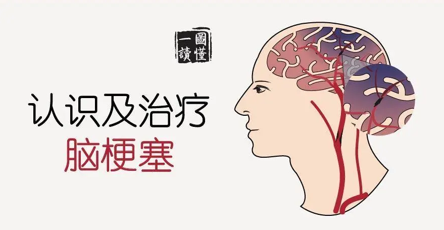 脑梗后肢体无力怎么办?