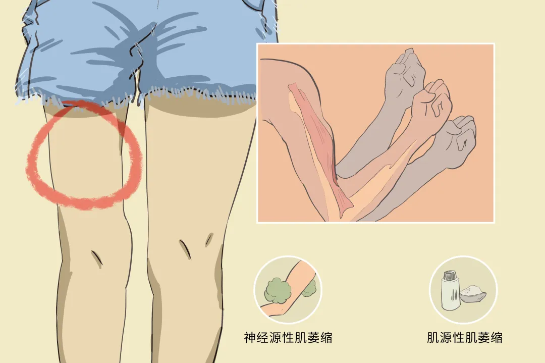 脑梗后遗症应对:提升全身力量的康复策略