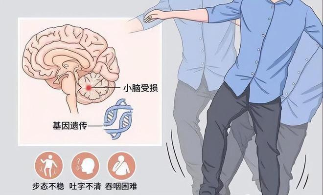 如何缓解共济失调患者走路不稳、进食呛咳问题？