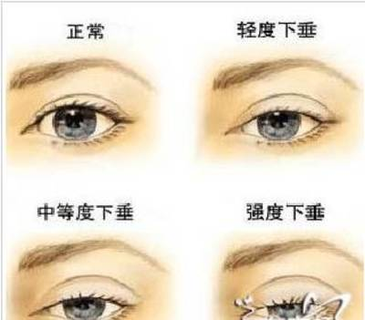 69eb8e3c064740a282b7b51a89785997.png