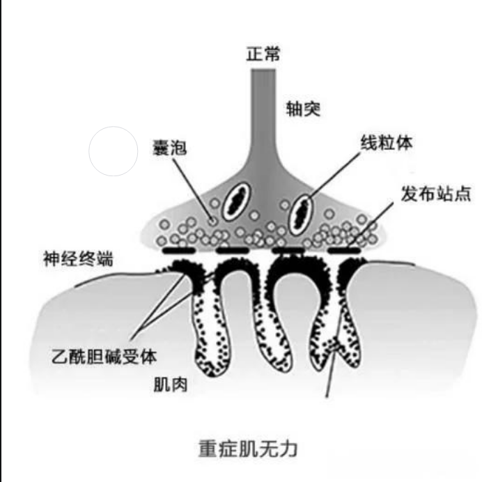 69eb8e3c064740a282b7b51a89785997.png