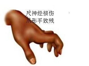 74a7b3058c7c4f13b1af1908efd5b1d8.png
