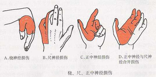 74a7b3058c7c4f13b1af1908efd5b1d8.png