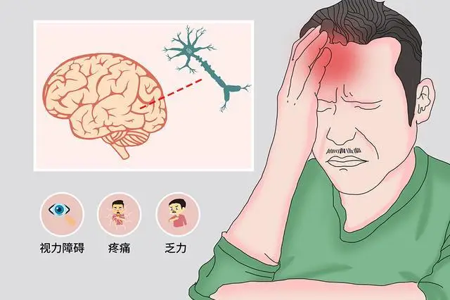 患者须知丨头脑晃动：脑出血患者不可忽视的后遗症及其管理
