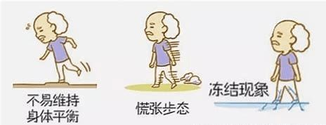 帕金森病患者走路小碎步的康复训练:重拾行走的自由