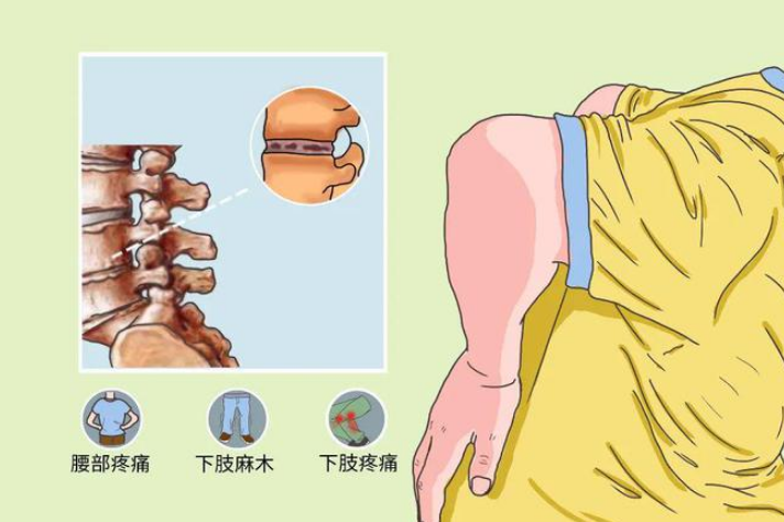 脊髓炎患者在饮食方面要注意什么？