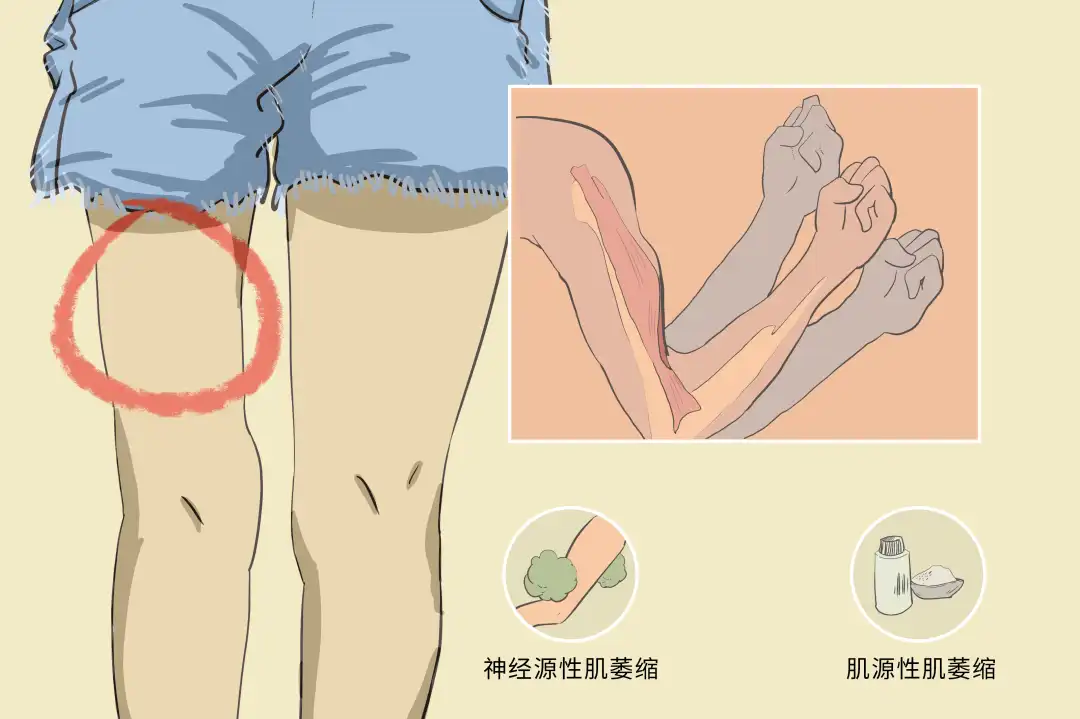 冬季肌肉萎缩护理：避免病情恶化的实用技巧