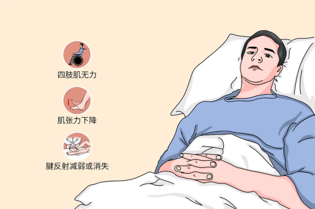 重症肌无力患者的日常锻炼：如何有效增强肌肉力量？