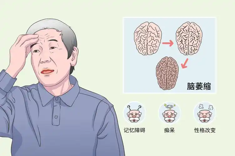 脑萎缩患者的饮食禁忌有哪些?