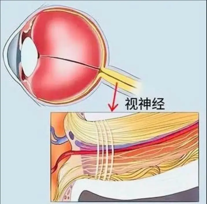 视神经萎缩的隐形威胁:不及时治疗,多久会失明?