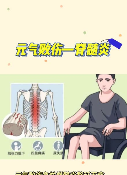 警惕！脊髓炎高危人群：这些因素可能诱发疾病