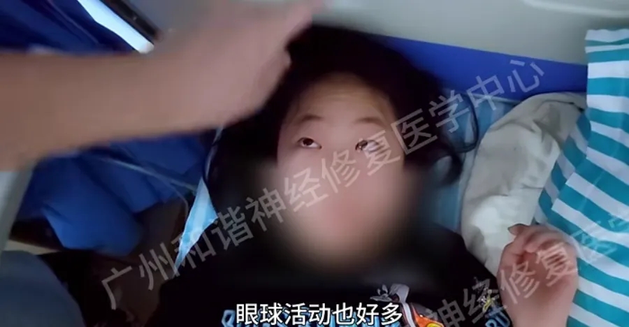 【查房日记】神经修复显奇效！12岁女孩重症肌无力症状大改善，眼睛睁得更大更明亮！