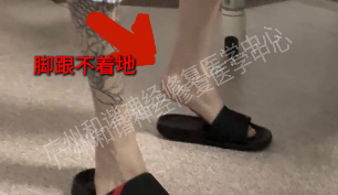 【案例纪实】19 岁青年，被马蹄内翻足困扰十年，他如何一步步走向 “平衡” 人生的？