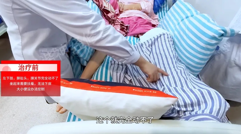 【案例纪实】少女意外跌落致脊髓损伤，神经修复与汗水勇气共铸康复之花