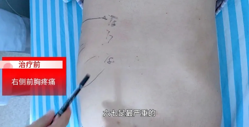 【案例纪实】一面锦旗一份肯定：精湛医术，助糖尿病周围神经病变患者解除痛苦