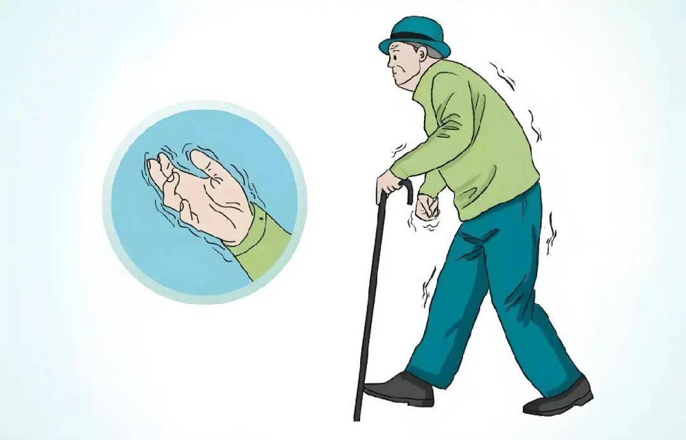 帕金森手抖患者必看！5个日常锻炼动作，轻松缓解震颤