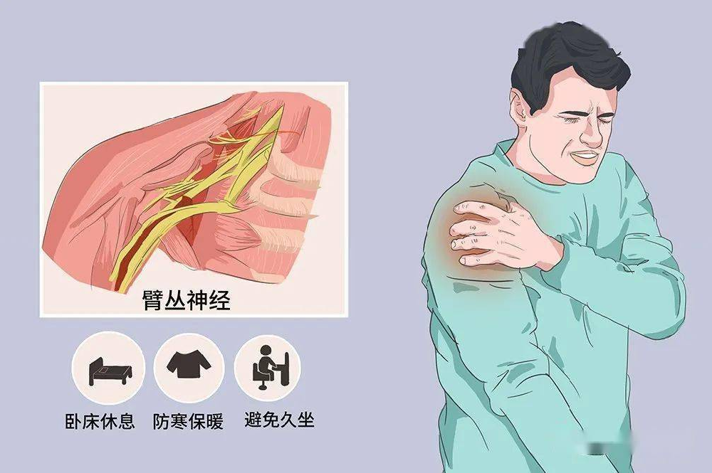 “我等了3个月，手还是抬不起来……”——臂丛神经损伤自愈的残酷真相