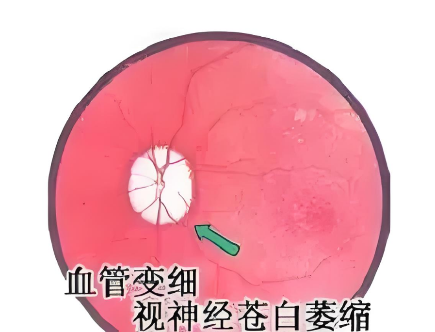 微信图片_20250617103003.png