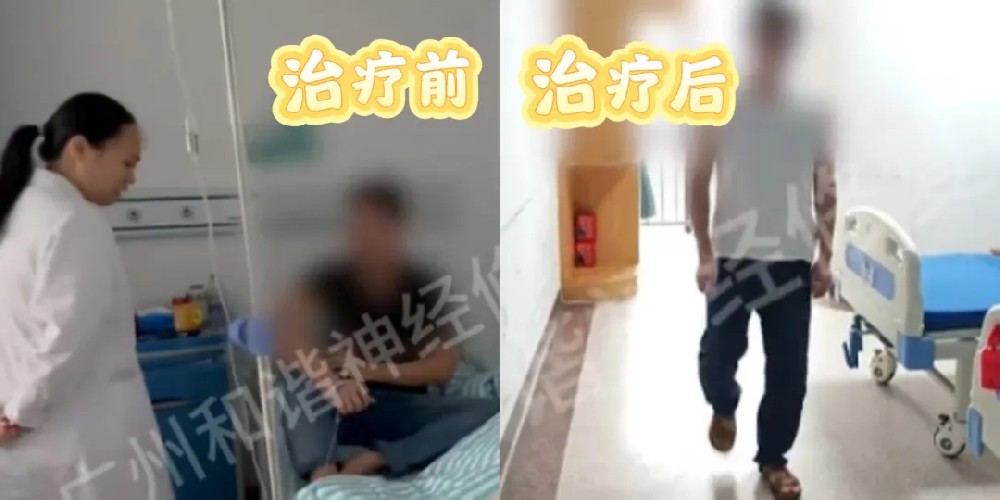 【纪实案例】瘫痪十年、无法下床!脊髓损伤患者靠神经修复实现 “行走自由”|广州脊髓损伤能恢复吗