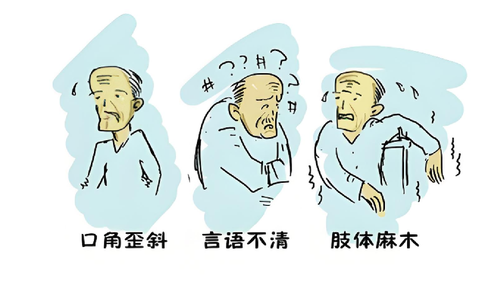 脑梗正年轻化！身体发出4个求救信号，千万别忽视