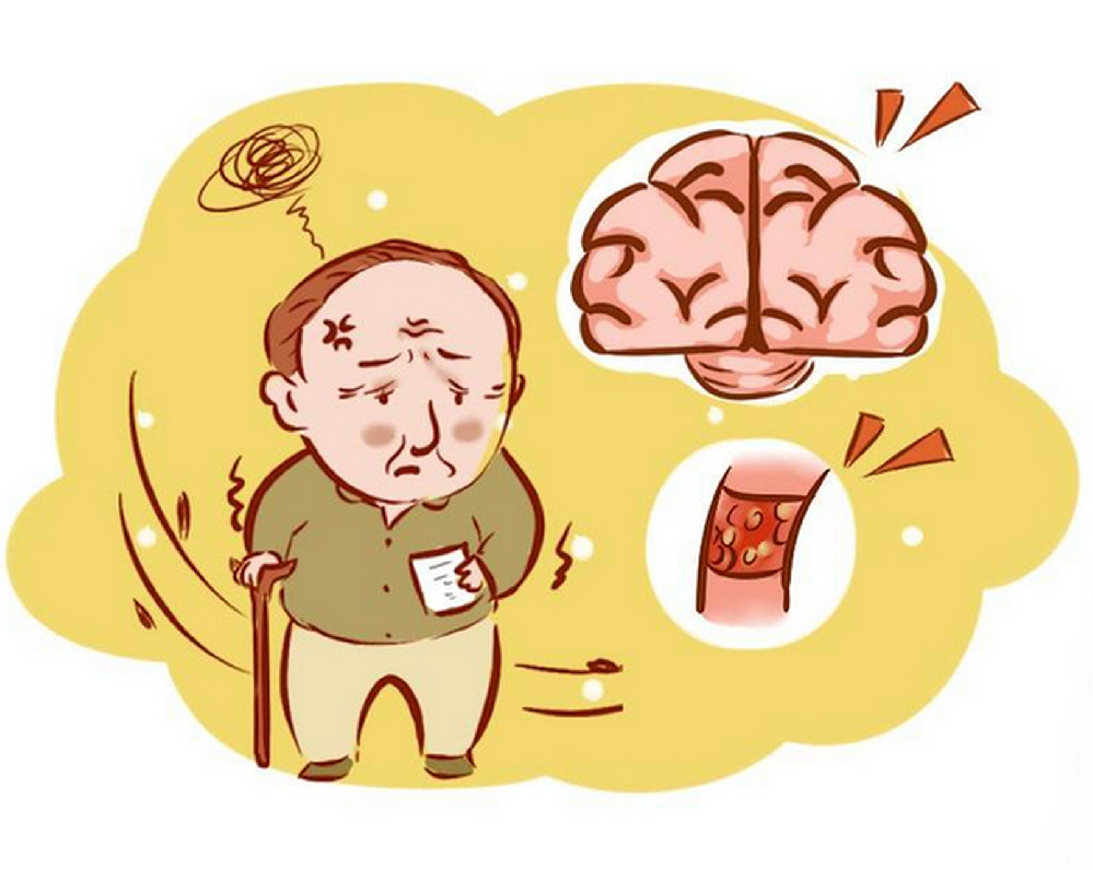 春季湿气重，脑梗患者饮食要这样吃