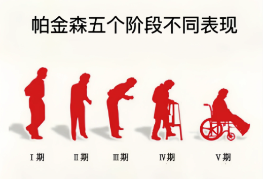 帕金森.png
