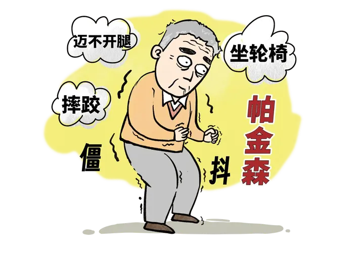 帕金森病：不只是“手抖”那么简单