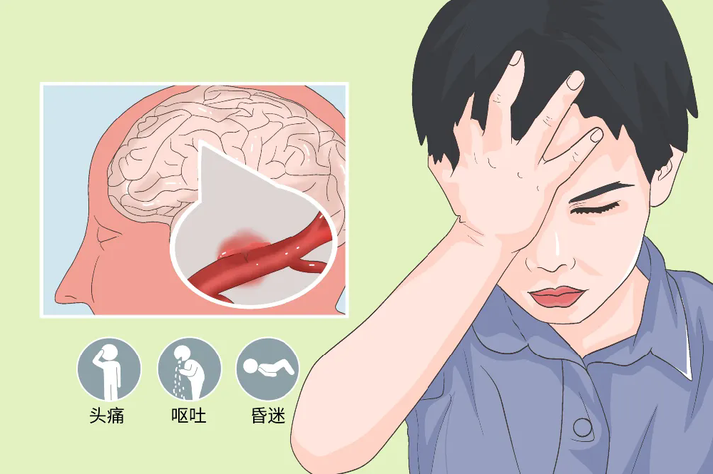 脑梗、脑出血后恢复快？对照看看你是否属于这3类情况
