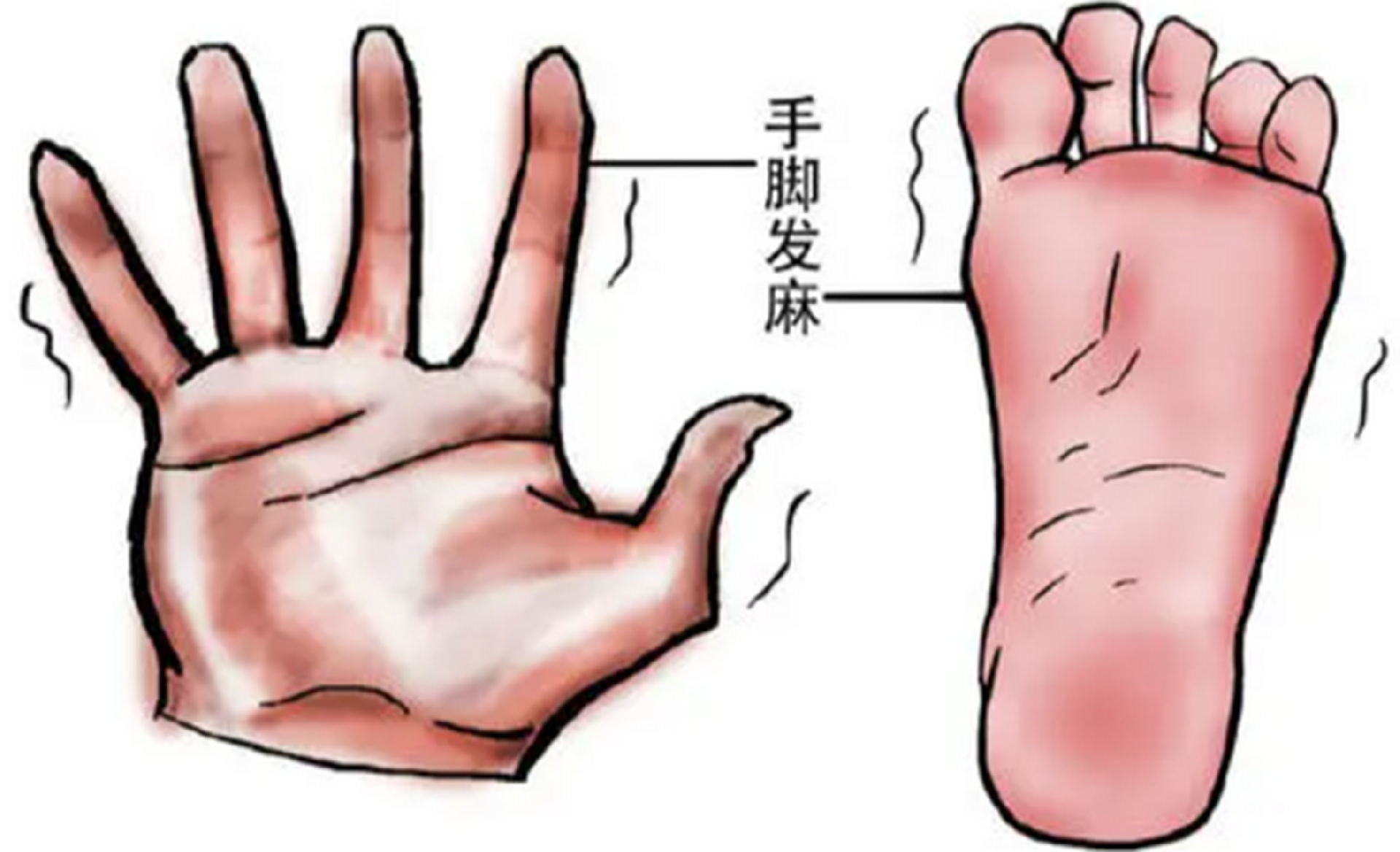 j.png
