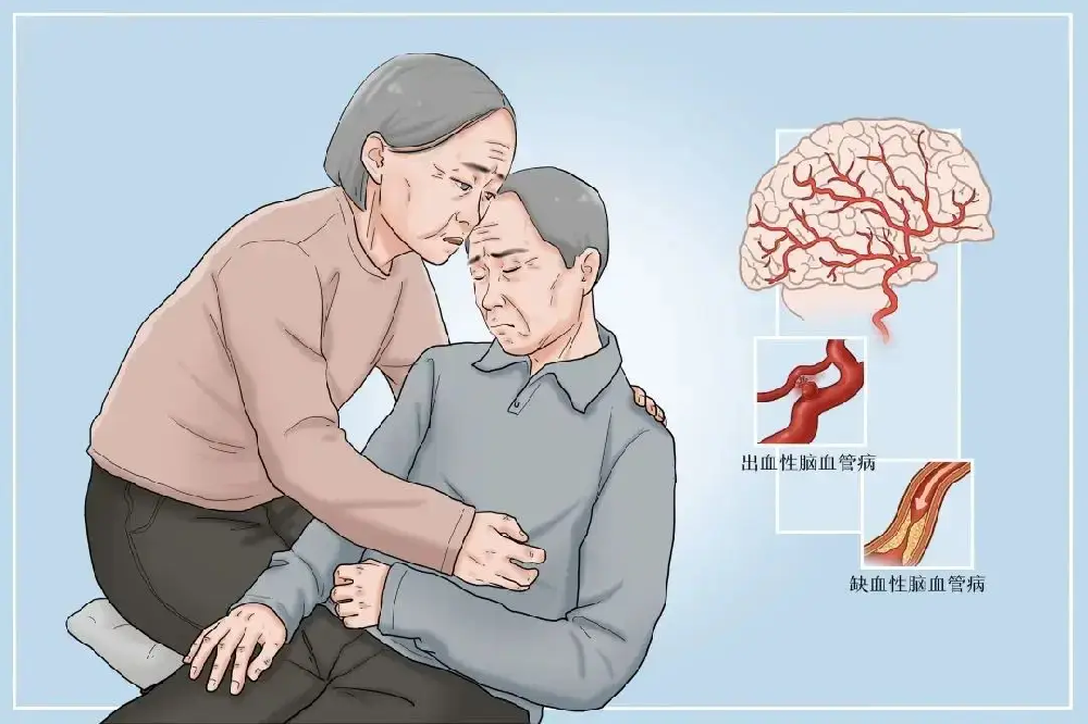 中风偏瘫二次复发率极高,做好这几点有效预防