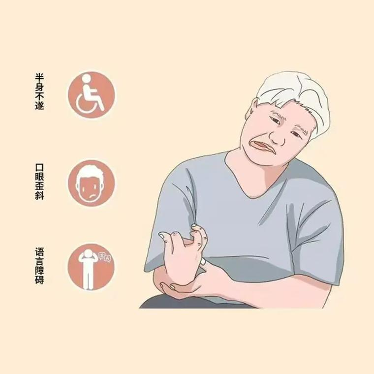 偏瘫分“软”和“硬”,一眼分清病灶在大脑还是脊髓