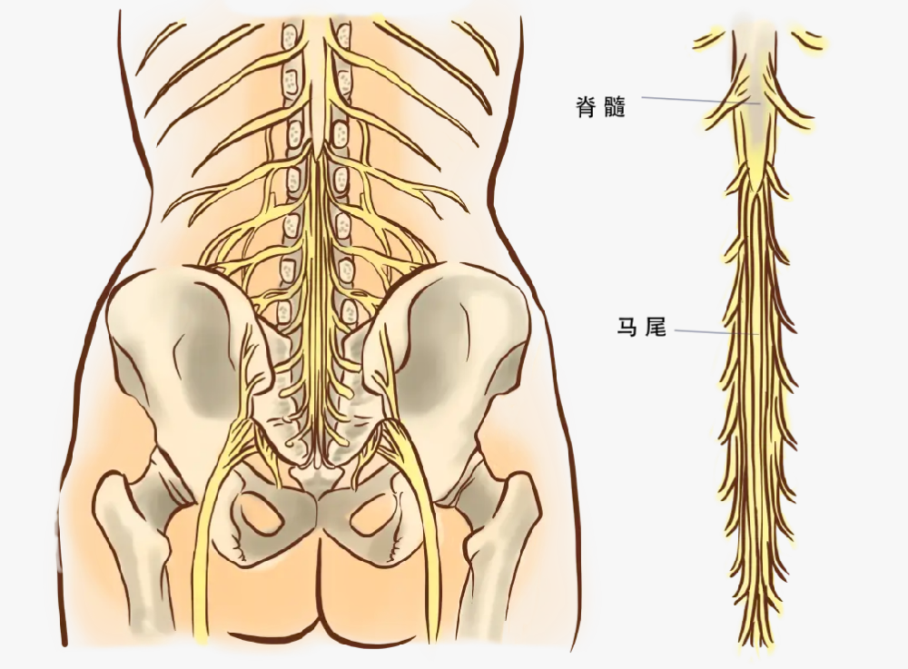 加重神经炎症、腰反复痛!马尾患者少吃这几种食物